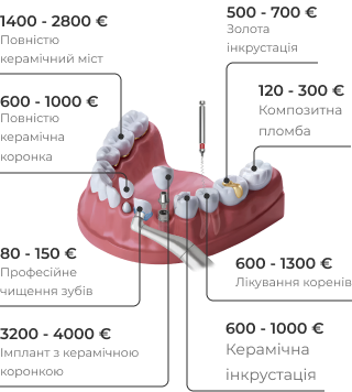 Pricing Schema Mobile
